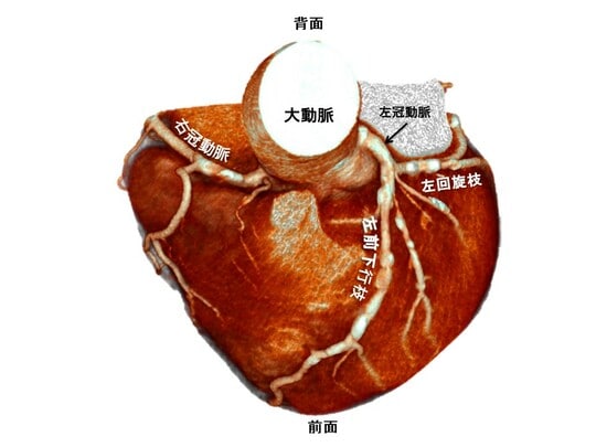 森山記念病院 内科・循環器 野池博文氏 作成