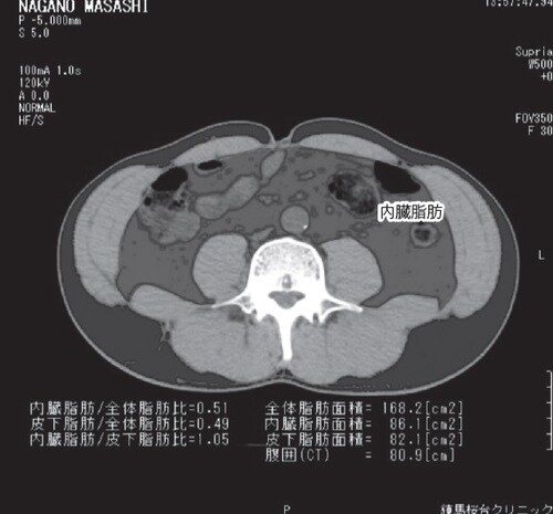 内臓脂肪面積は86.1㎠で、一応正常範囲内だが、若干まだぽっちゃりとしている