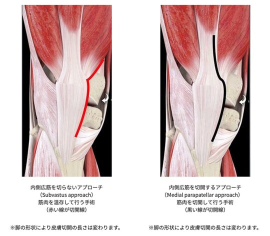 「3D4medical」より筆者作成