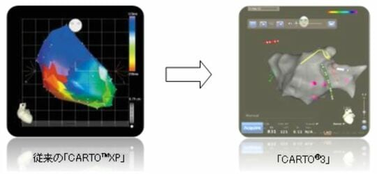 ※画像転用:ジョンソン・エンド・ジョンソン(株)メディカルカンパニー https://www.innervision.co.jp/041products/2010/p1009_21.html