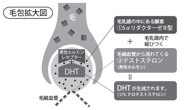 テストステロンが5αリダクターゼの作用により、DHT に変換されます。次いでDHT が男性ホルモンレセプターと結合し、さまざまな遺伝子に作用して脱毛を引き起こします。