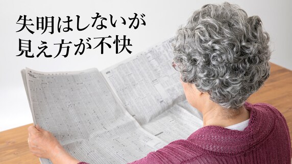 不快な視界の歪みをもたらす「黄斑前膜」…いつ手術するべき?