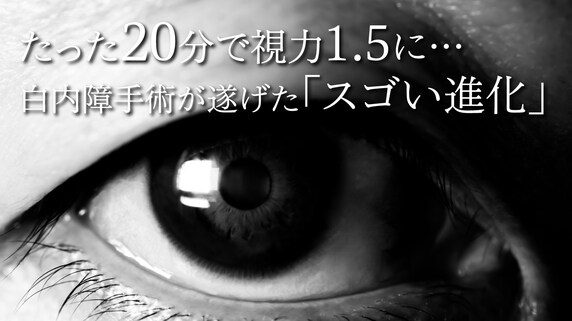 たった20分で視力1.5に…白内障手術が遂げた「スゴい進化」