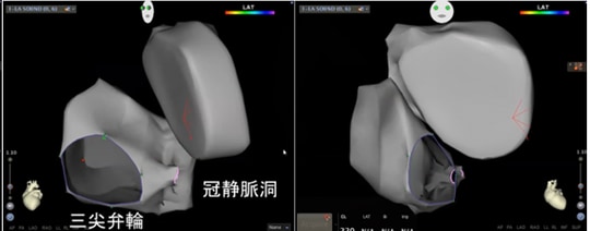 ［図表4］3次元画像システム②