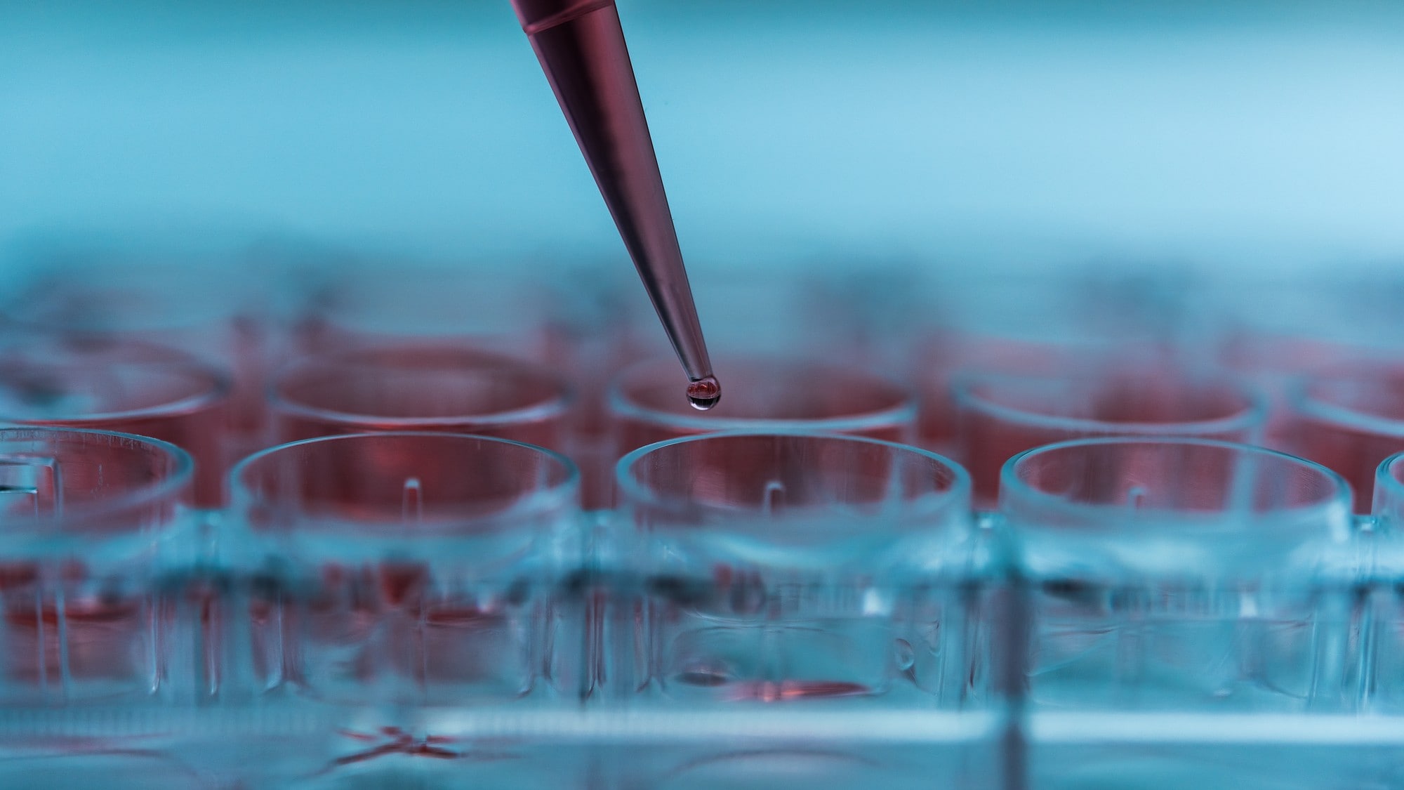 現役世代も知っておきたい変形性膝関節症の最新治療とは?