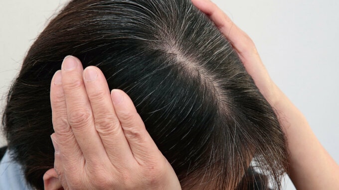 髪の毛はどのような構造・成分で構成されているのか？