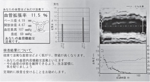 筆者のランニング開始1年後の検査結果。若い人と同様の結果です（54歳時）。