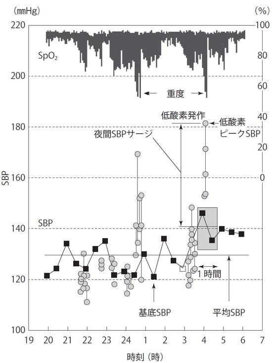  SBP：収縮期血圧  ※自治医科大学循環器内科学部門　苅尾七臣教授より資料提供