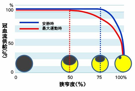 森山記念病院　内科・循環器　野池博文氏 作成