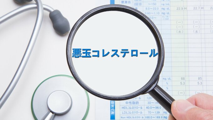 高LDLは「動脈硬化」に繋がる…。検査すべき“ハイリスクな人”とは？【総合内科専門医が解説】