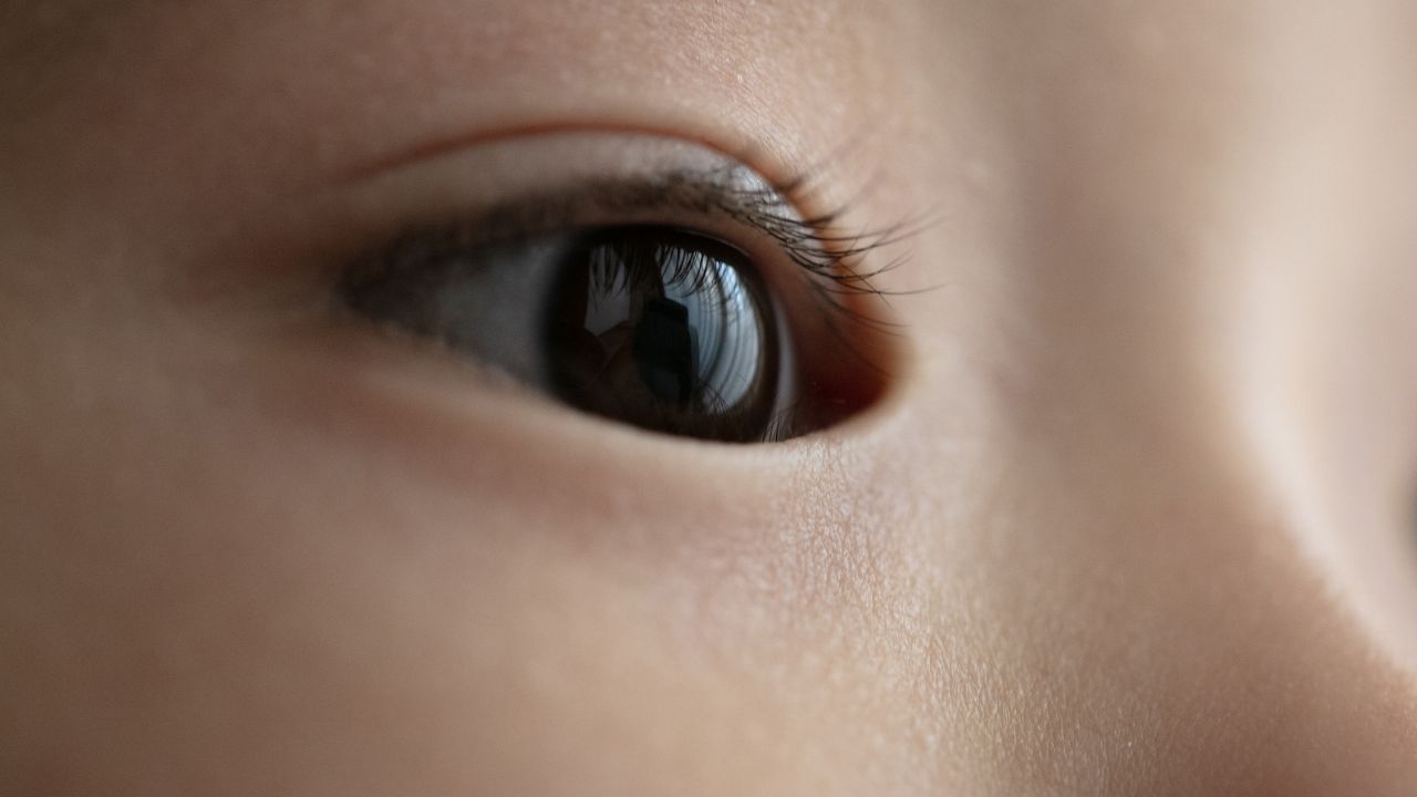 子どもの「斜視」…病気？それとも遺伝？治療法について眼科医が解説