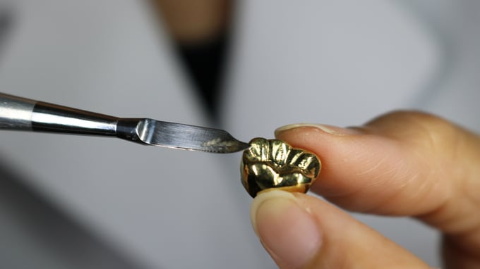 歯科治療で金属アレルギーを発症!? どんな症状が出るのか