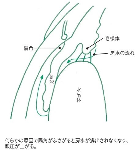 出所：平松類著『自分でできる！人生が変わる緑内障の新常識』（ライフサイエンス出版）