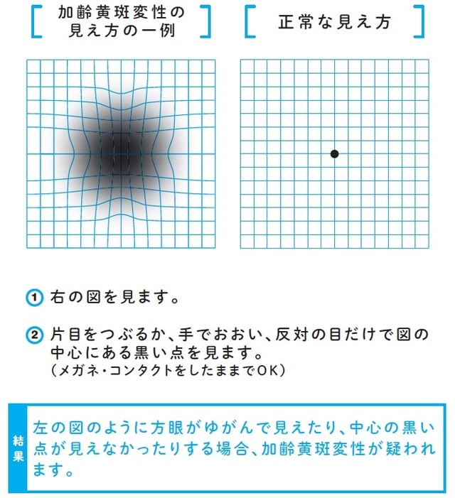 出典：梶原一人著『放っておくと怖い目の症状25』（ダイヤモンド社）より
