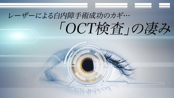レーザーによる白内障手術成功のカギ…「OCT検査」の凄み