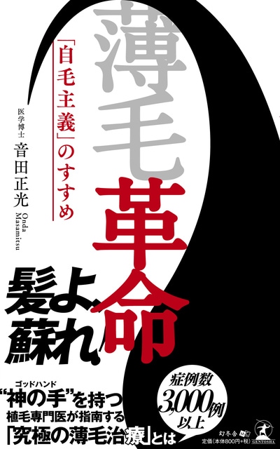 薄毛革命　「自毛主義」のすすめ