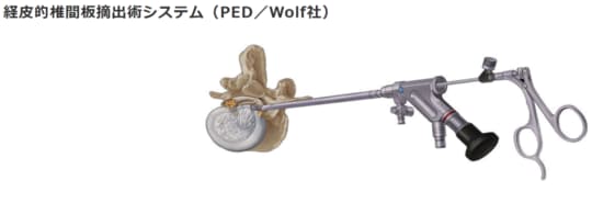 ［図表1］経皮的椎間板摘出術システム（PED／Wolf社）