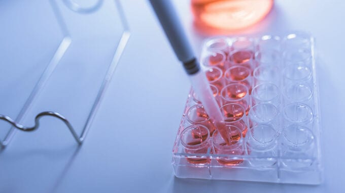 再生医療　商用段階に　日経1面記事の考え方は？