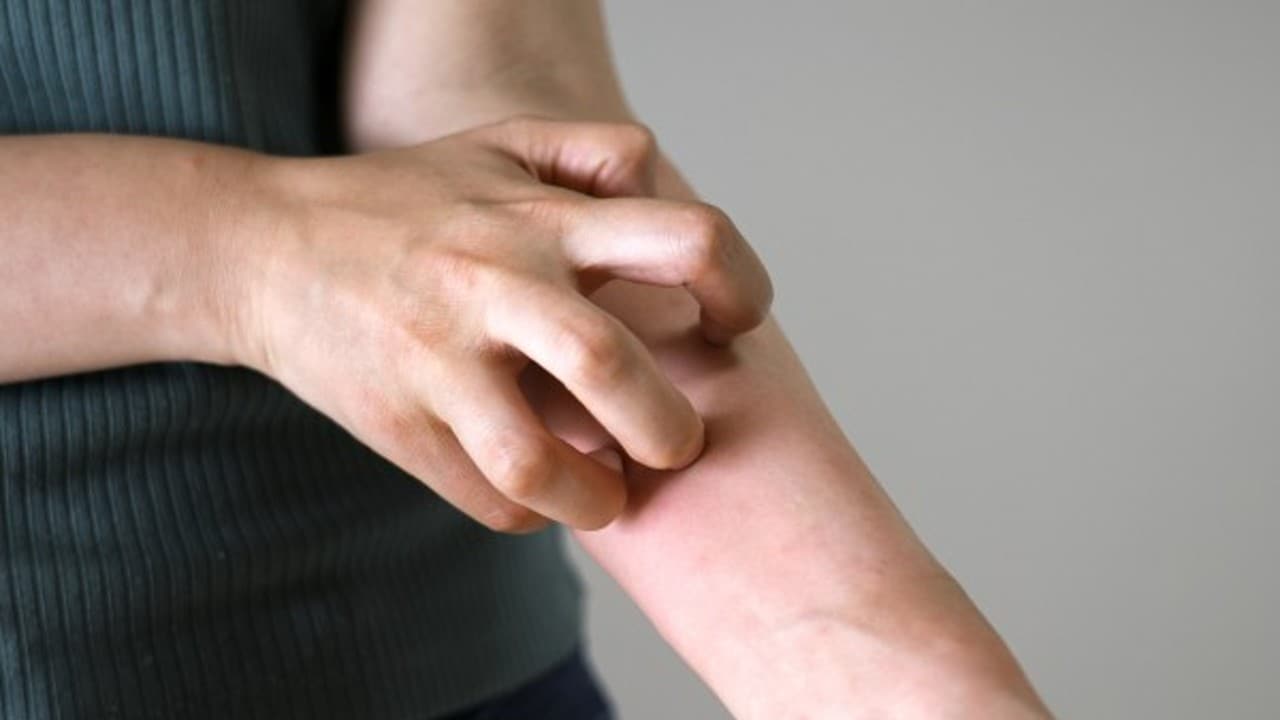 【秋冬に要注意】コロナ禍で増加した「皮膚掻痒症」とは