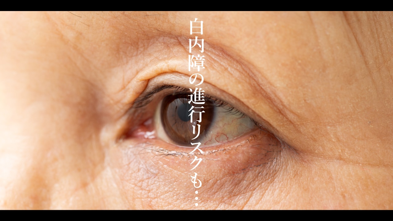 白内障の進行リスクも…視界が歪む疾患「黄斑円孔」の治療法