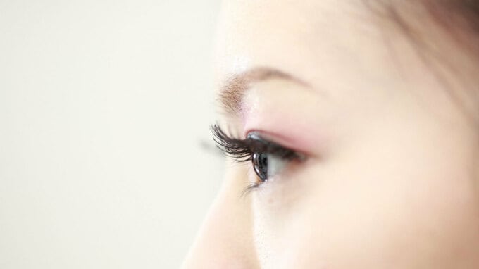 目に刺さる「逆さまつげ」･･･治療法はあるのか？