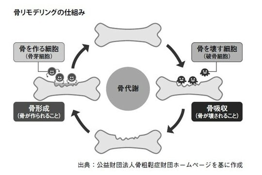 出所：『ねこ背が気になったら骨粗鬆症を疑いなさい』（幻冬舎メディアコンサルティング）より抜粋