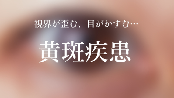 視界が歪む 目がかすむ 増加する 黄斑疾患 の原因とは 富裕層向け資産防衛メディア 幻冬舎ゴールドオンライン