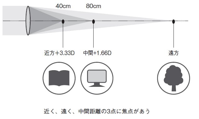※D:眼内レンズの度数を表す単位
