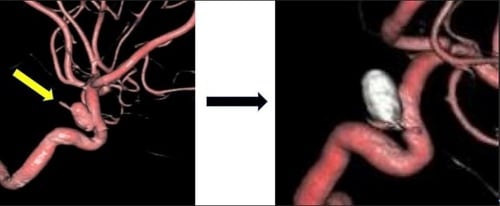 ありがとうございます。