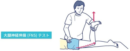 ［図表3］大腿神経伸長（FNS）テスト