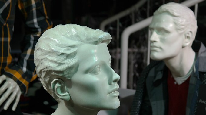 AGAだけじゃない･･･薄毛の「種類」とその原因