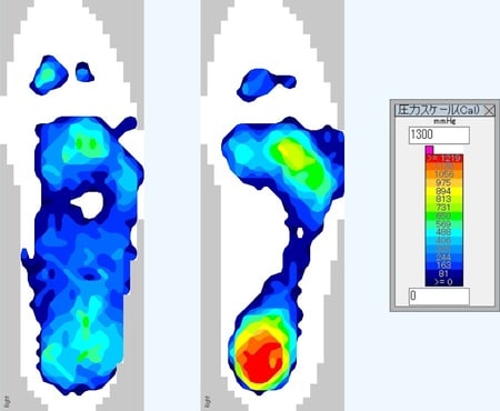 UTIPPA着用時（左）と素足を想定した測定用シューズ着用時（右）の足の圧力分布画像