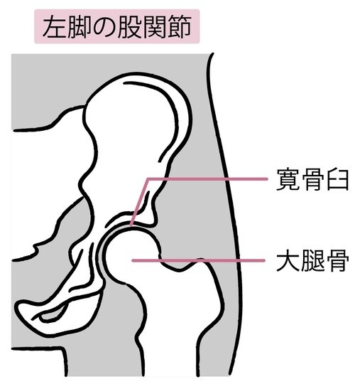 ［図表1］左脚の股関節