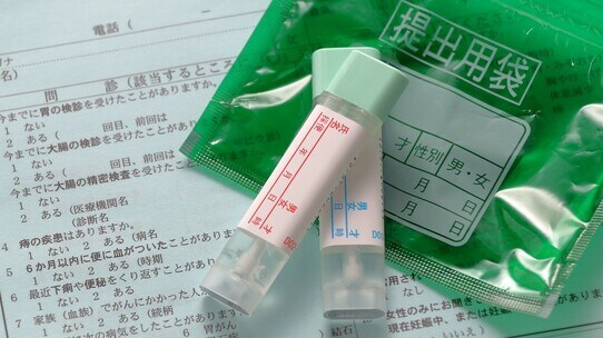 便潜血検査に異常がでたら?がんの心配はどれくらい?【専門医が解説】