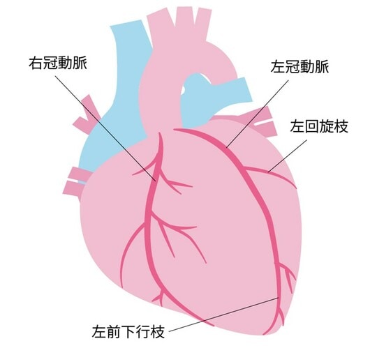 右冠動脈と左冠動脈があり、左冠動脈はさらに左前下行枝、左回旋枝に分岐する