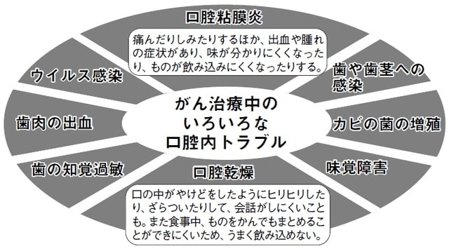 出典：静岡県立静岡がんセンター「がん治療中のお口のトラブルケア」