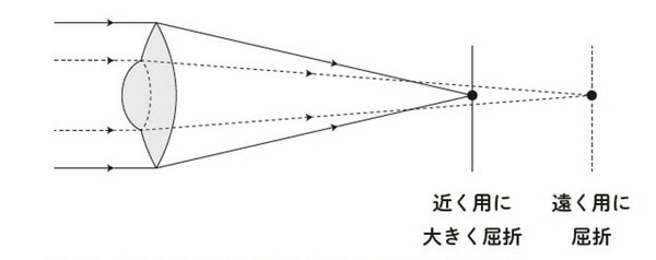 ［図表1］屈折型の多焦点眼内レンズの形状および集光