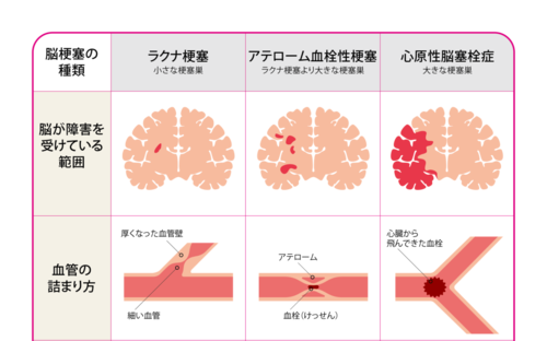 ※脳卒中データバンク2021より作図