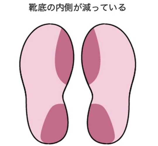 ［図表3］靴底の内側が減っている