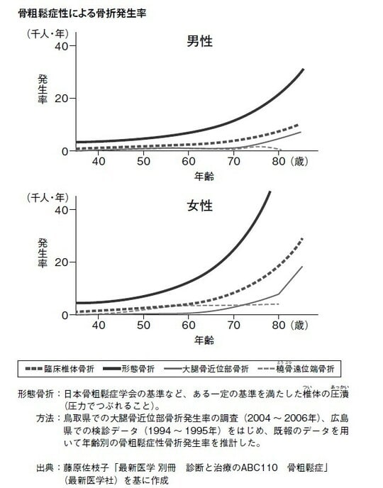 出所：『ねこ背が気になったら骨粗鬆症を疑いなさい』（幻冬舎メディアコンサルティング）より抜粋