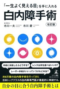 「一生よく見える目」を手に入れる白内障手術 改訂版
