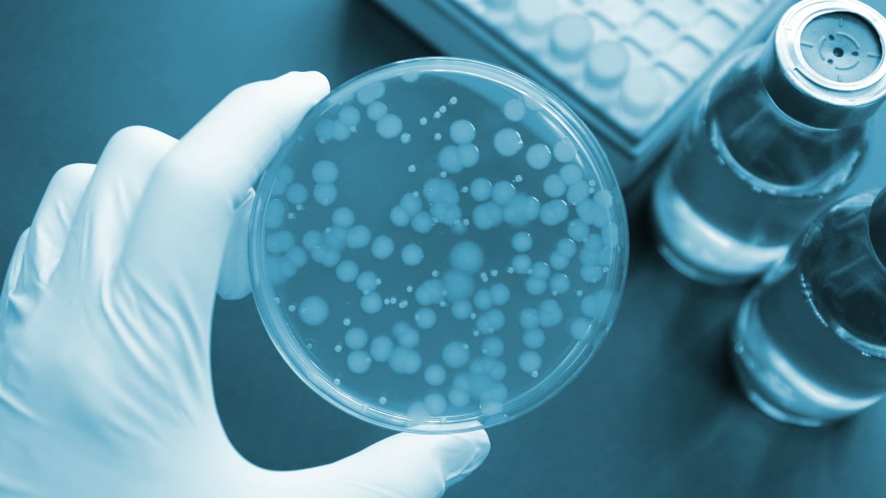 微生物で「抗体医薬」安く 関連銘柄の探し方