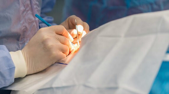 眼科医が「レーザー白内障手術」をすすめる本当のワケ