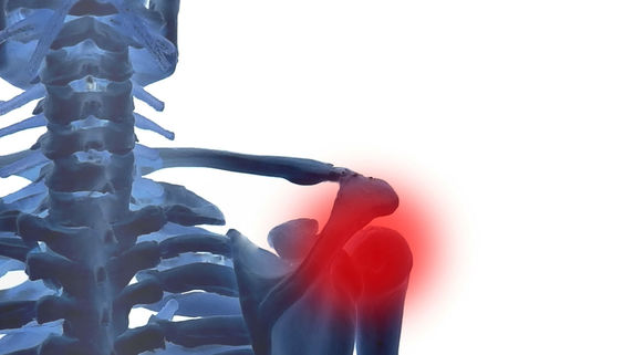 肩の痛み…「正しい診断・治療」ができる医師の見極め方