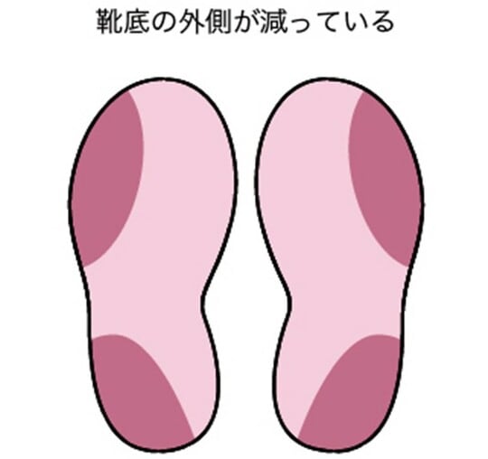 ［図表1］靴底の外側が減っている
