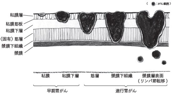 国立がん研究センターの統計より