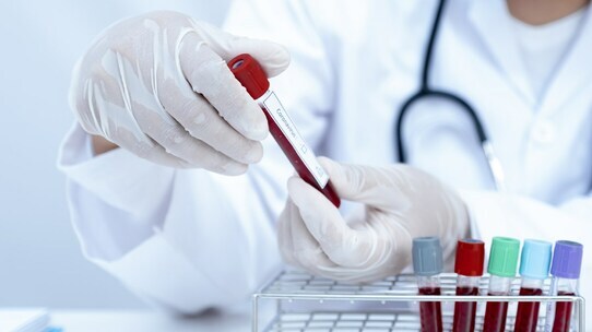 急増する“50歳未満の大腸がん”を「血液検査」で早期発見!? リキッドバイオプシーの最新研究【医師が解説】