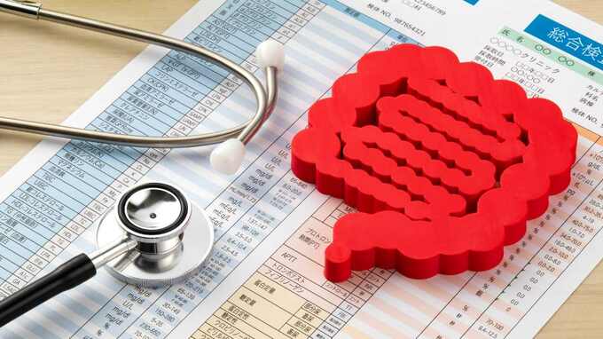 男性の10人に1人が罹患する「大腸がん」。男性ほど影響大、あまり知られていない「大腸がんのハイリスク要因」とは？【医師が解説】