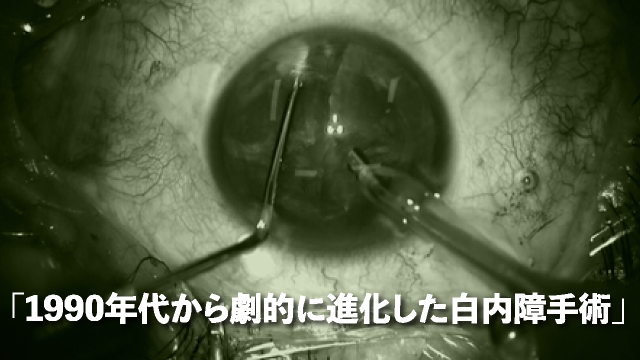 手探り で麻酔注射 1990年代まで行われていた白内障手術 富裕層向け資産防衛メディア 幻冬舎ゴールドオンライン