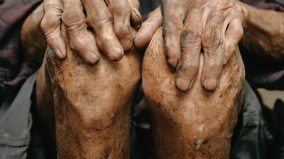 脳梗塞で麻痺が残った「年金6万円の80歳父」、お金がなくて選択した“激安”老人ホーム。あんなに恰幅がよかったのに、入居3ヵ月で骨と皮に…理由を尋ねた50歳長男「施設側の回答」に唖然【FPが解説】